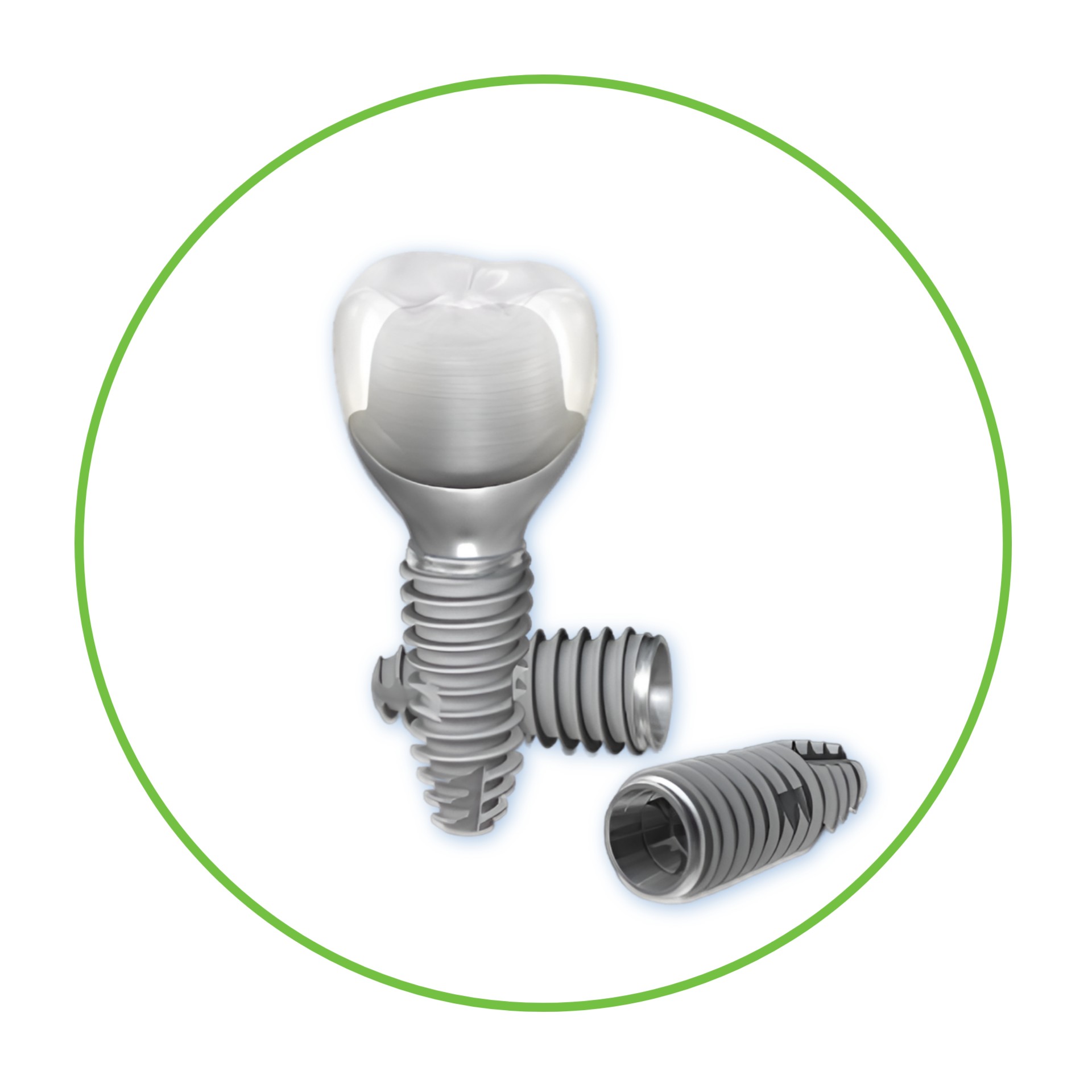 зубной имплант